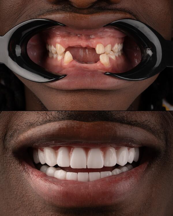 Before & After Closeup